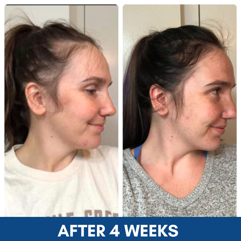 Hair Growth Serum Roll-On– Thicker, Stronger Hair & Reduced Hair Loss