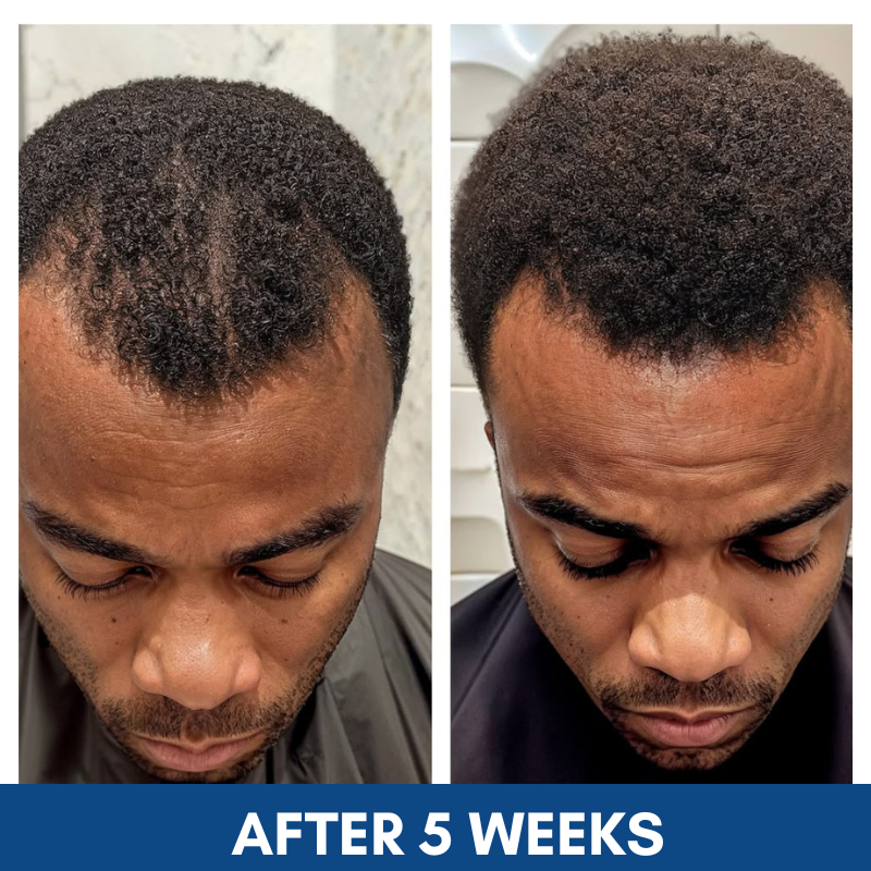 Hair Growth Serum Roll-On– Thicker, Stronger Hair & Reduced Hair Loss